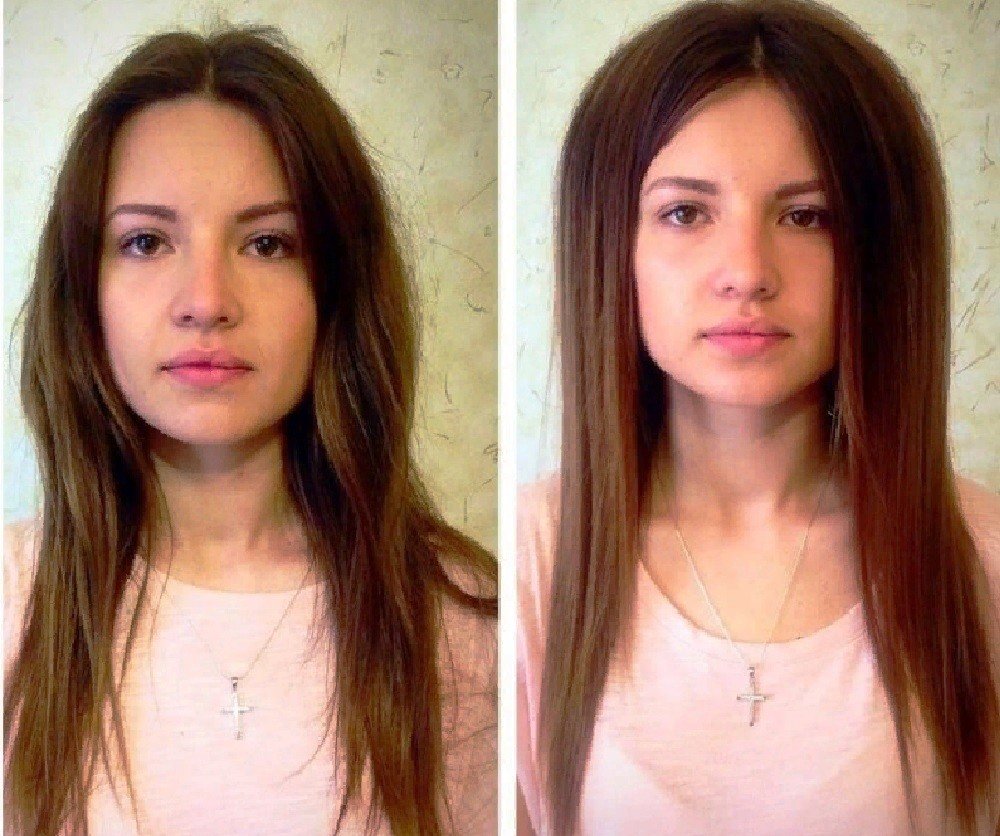 Прикорневой буст ап