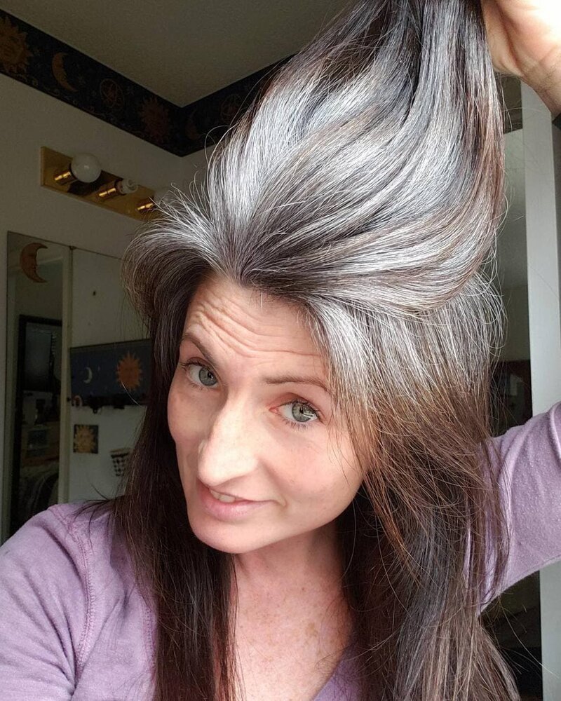 Седина волос