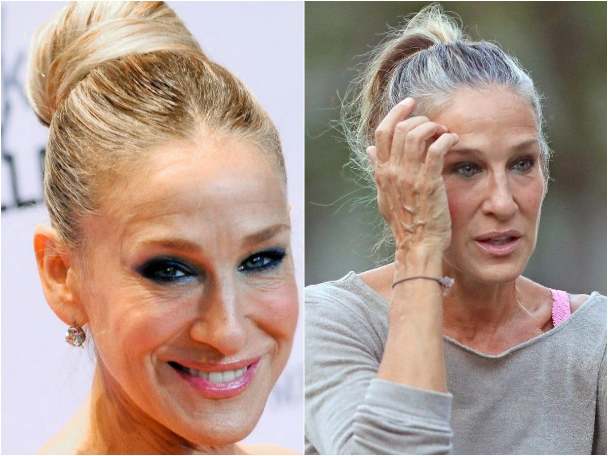 Пучки седых волос