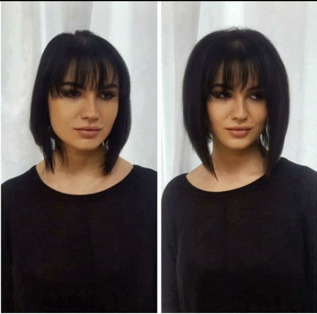 Флисинг прикорневой