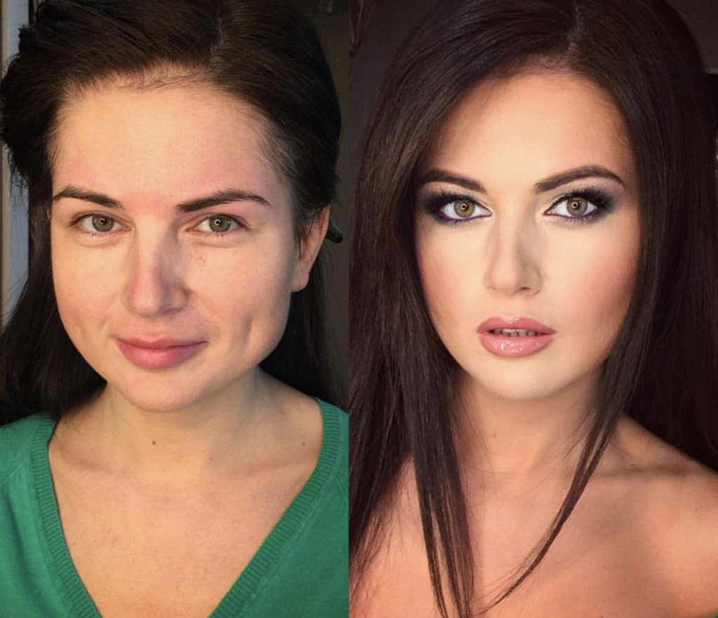 Ульяна Старобинская нависшее веко