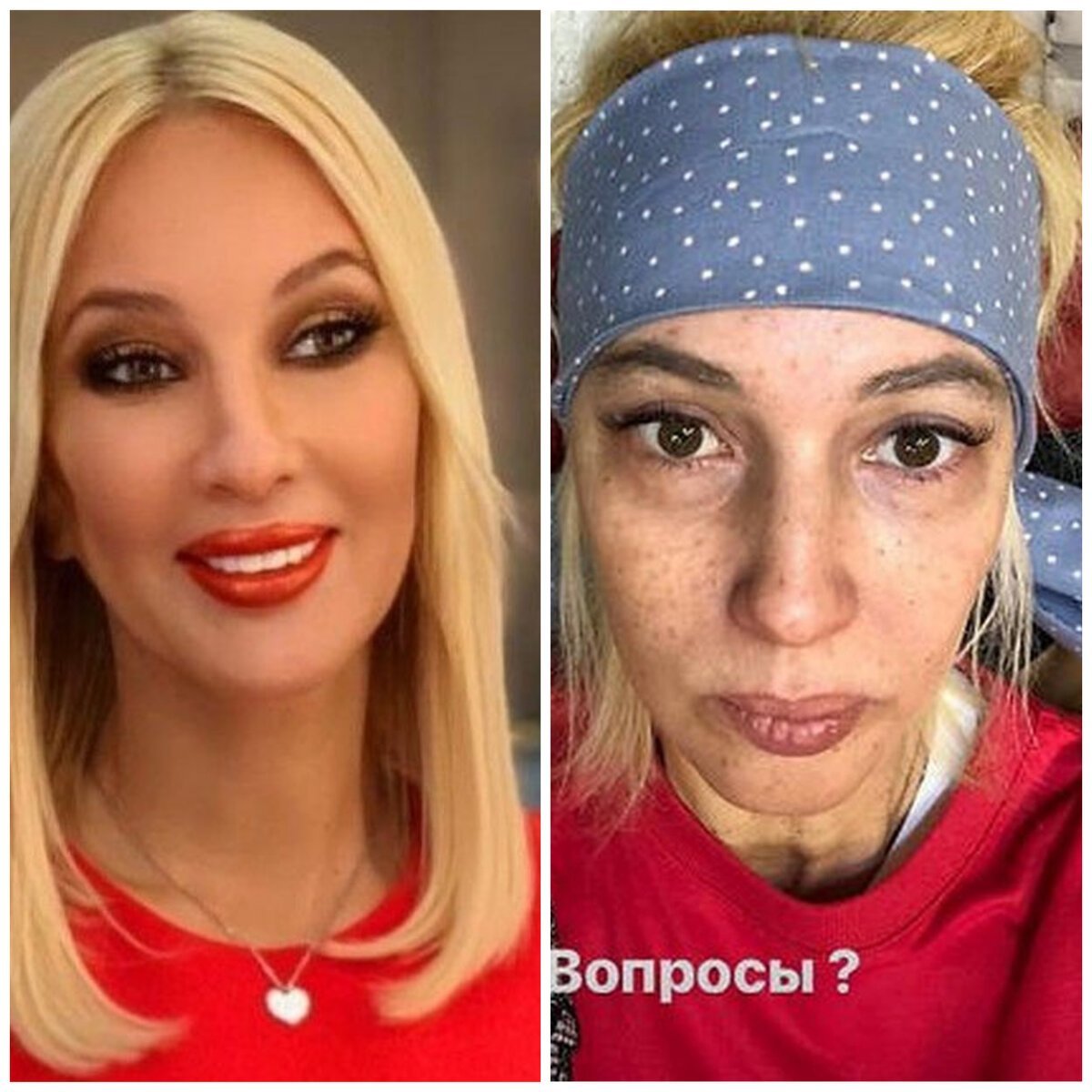 Лера Кудрявцева без макияжа