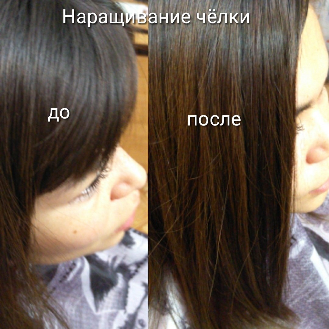 Наращивание волос височной зоны