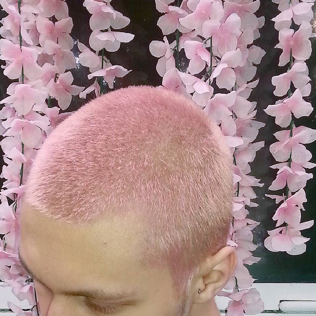 Розовая лысина