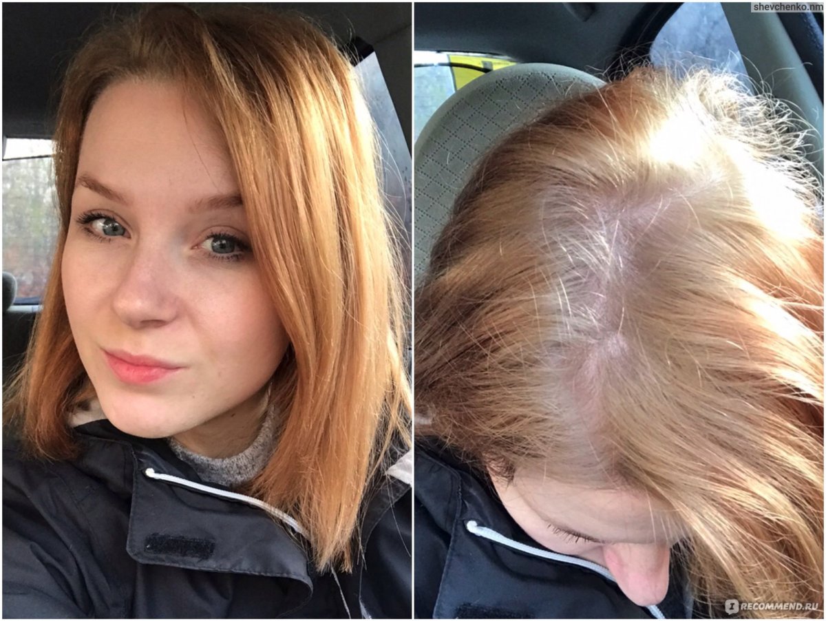 Гарньер 8.1 и 9.1