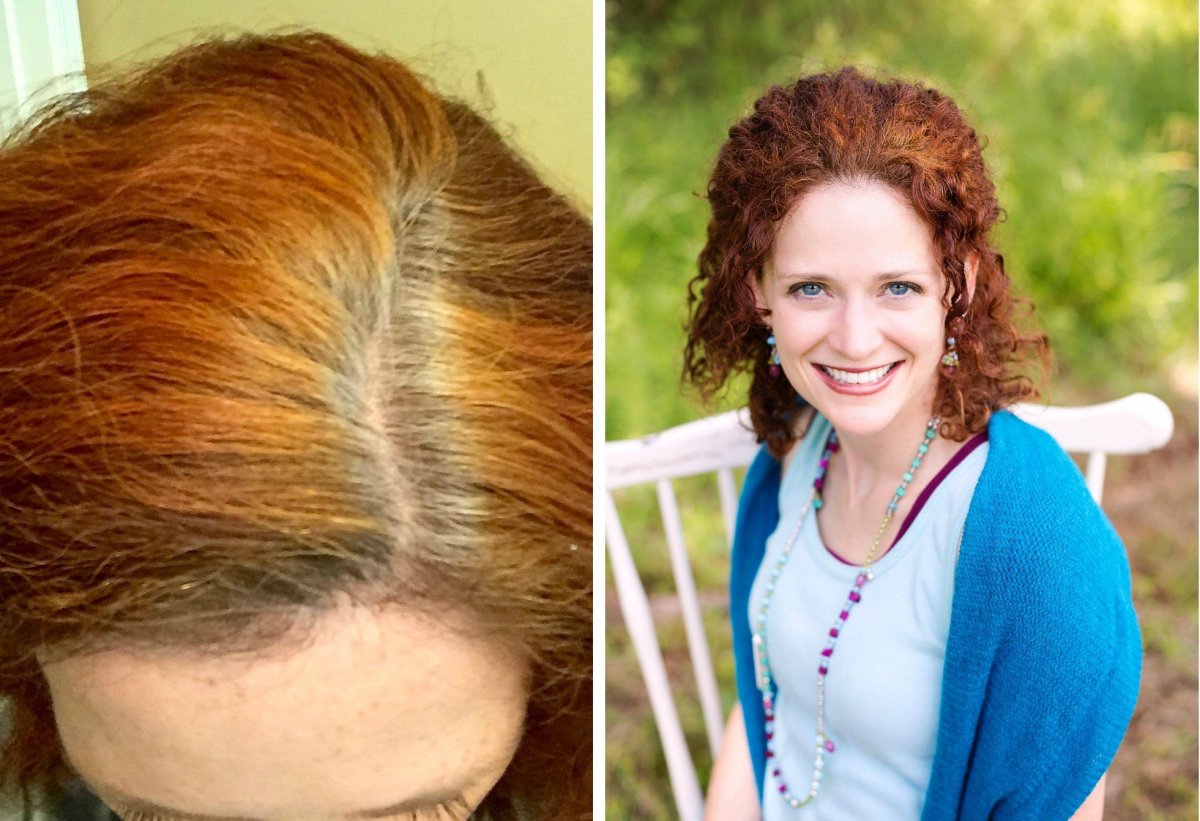 Седина на рыжих волосах