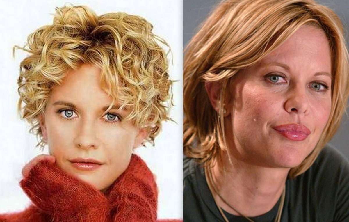 Биозавивка на крупные коклюшки на средние волосы