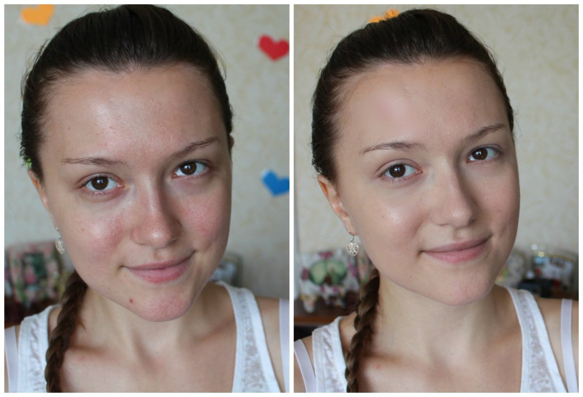 Неровный тон кожи