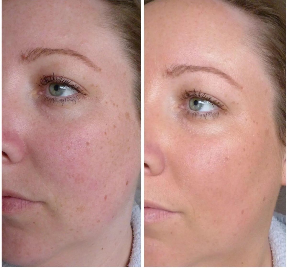 Гоар Аветисян чудеса