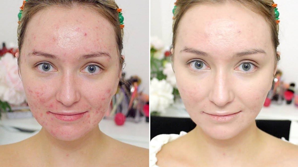 Макияж на проблемной коже до и после