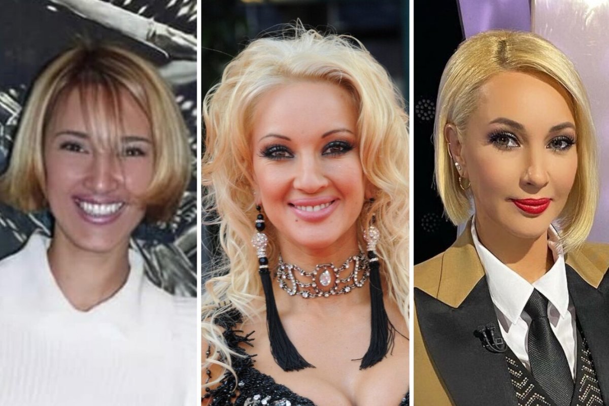 Лера Кудрявцева до операции