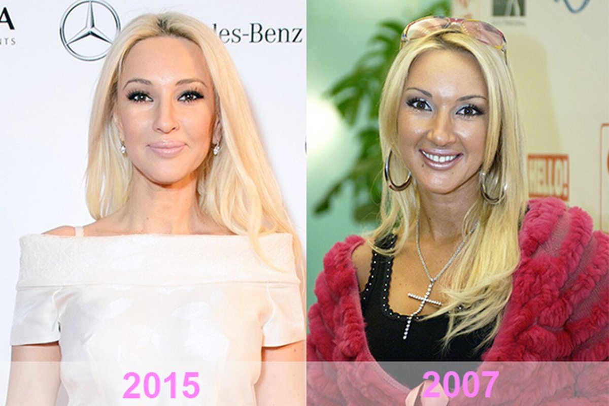 Лера Кудрявцева до