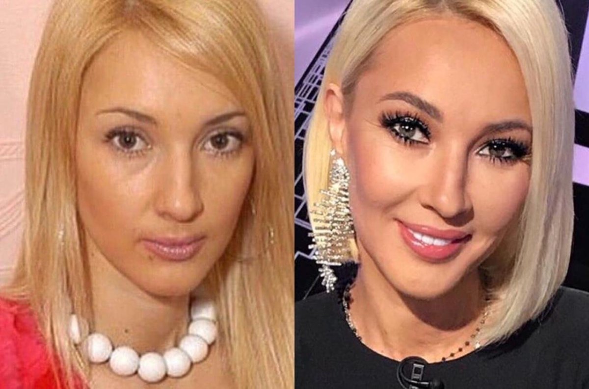 Лера Кудрявцева с челкой