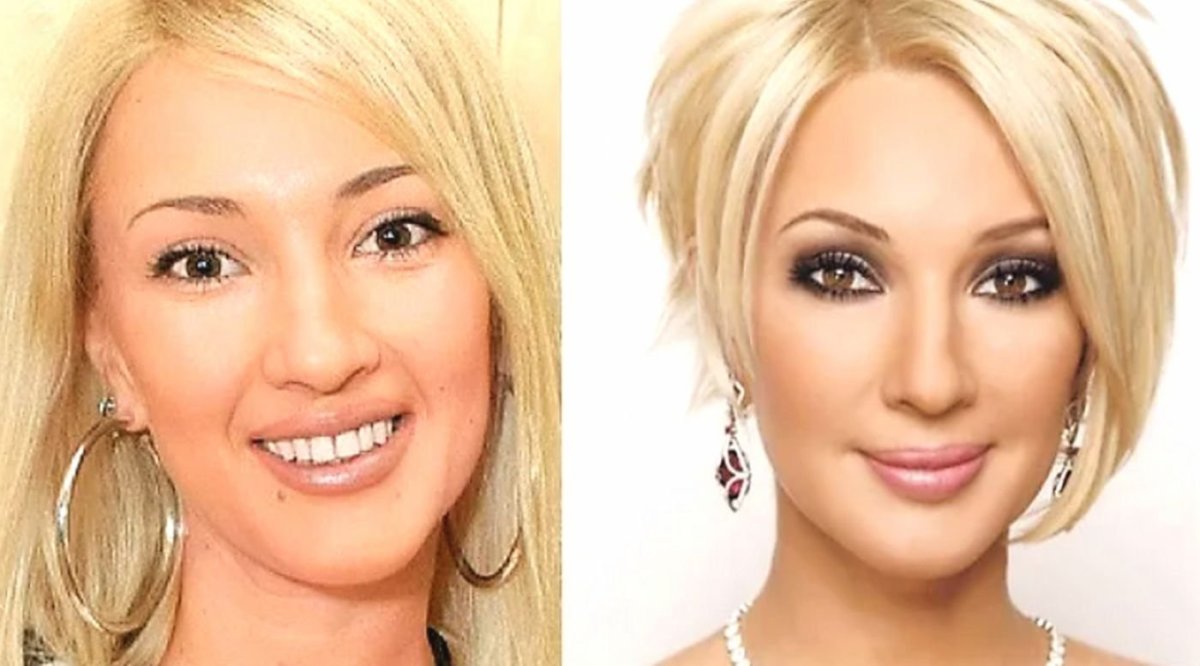 Лера Кудрявцева до пластики