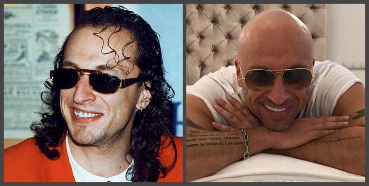 Дмитрий Нагиев зубы