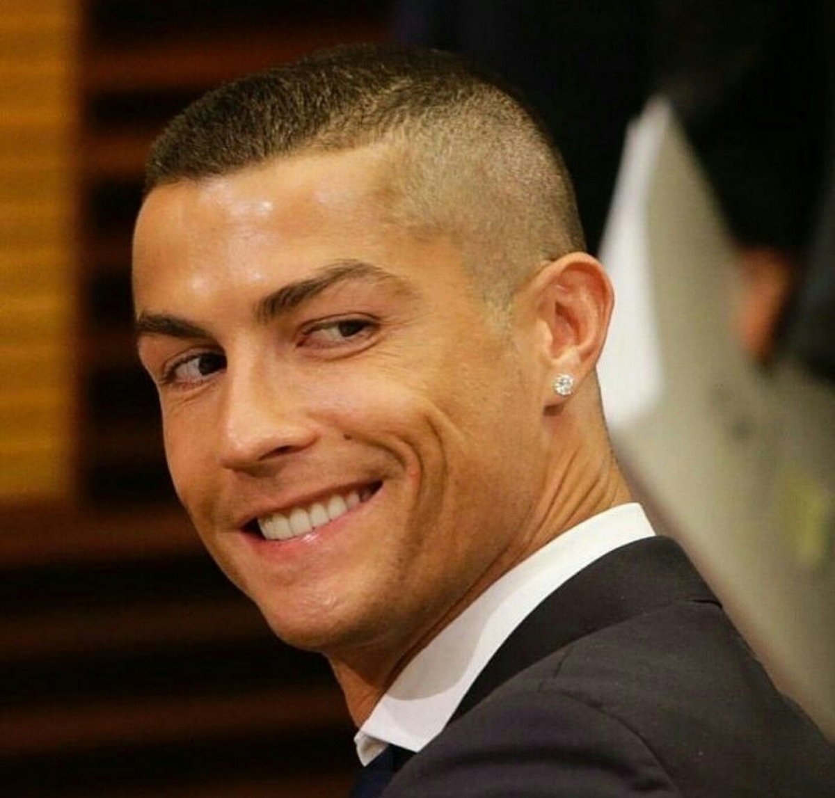 Роналду лысый