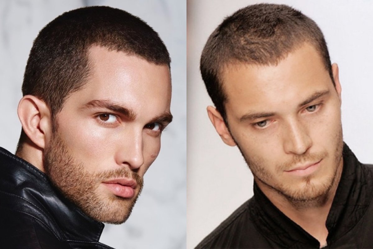 Короткие мужские стрижки с залысинами