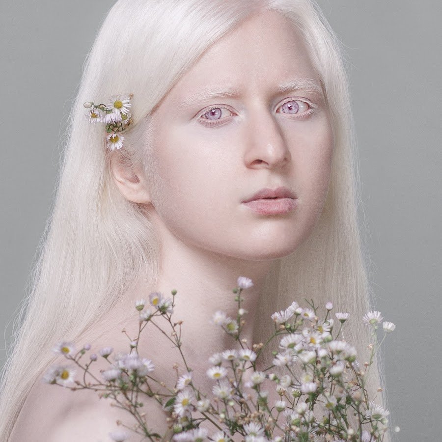 Натиа Макаридзе альбинос