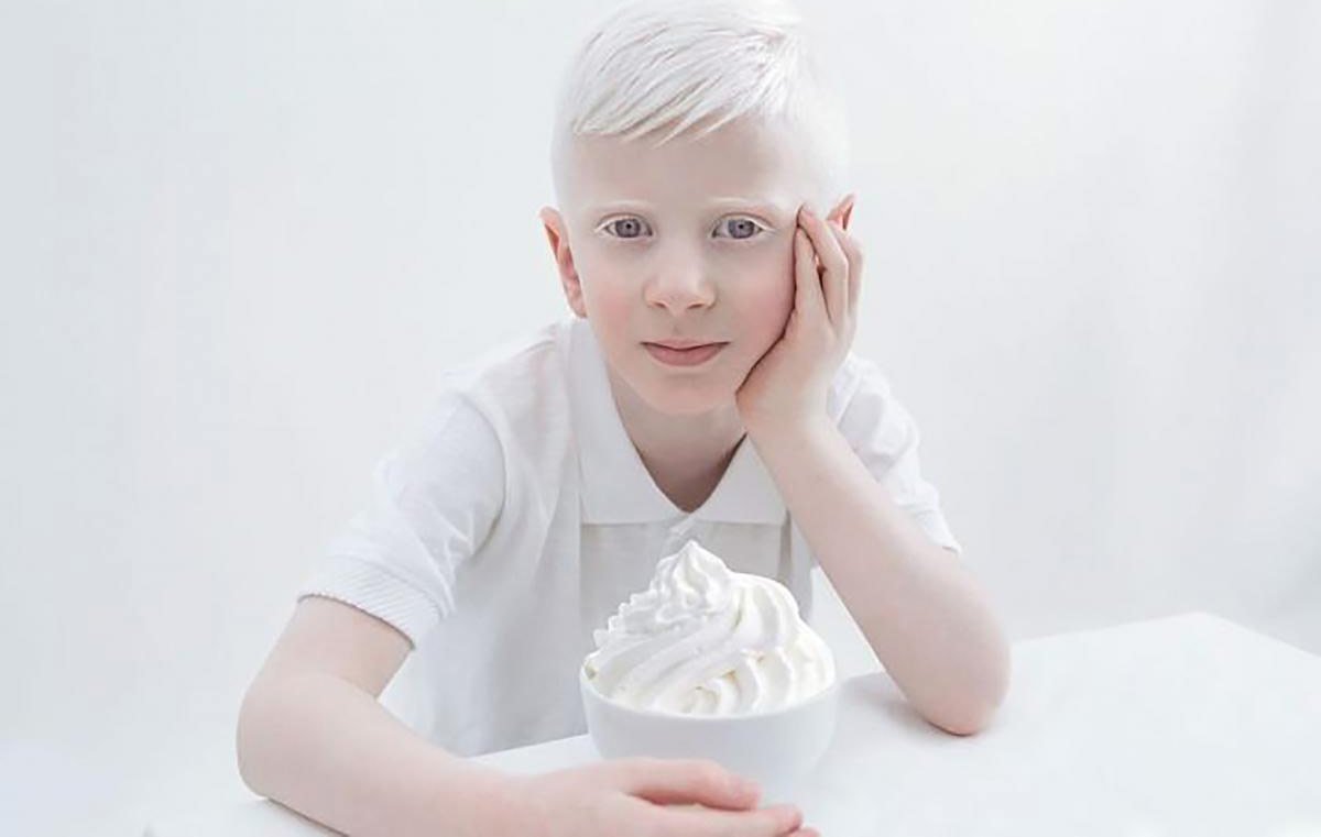 Саша Смирнов альбинос