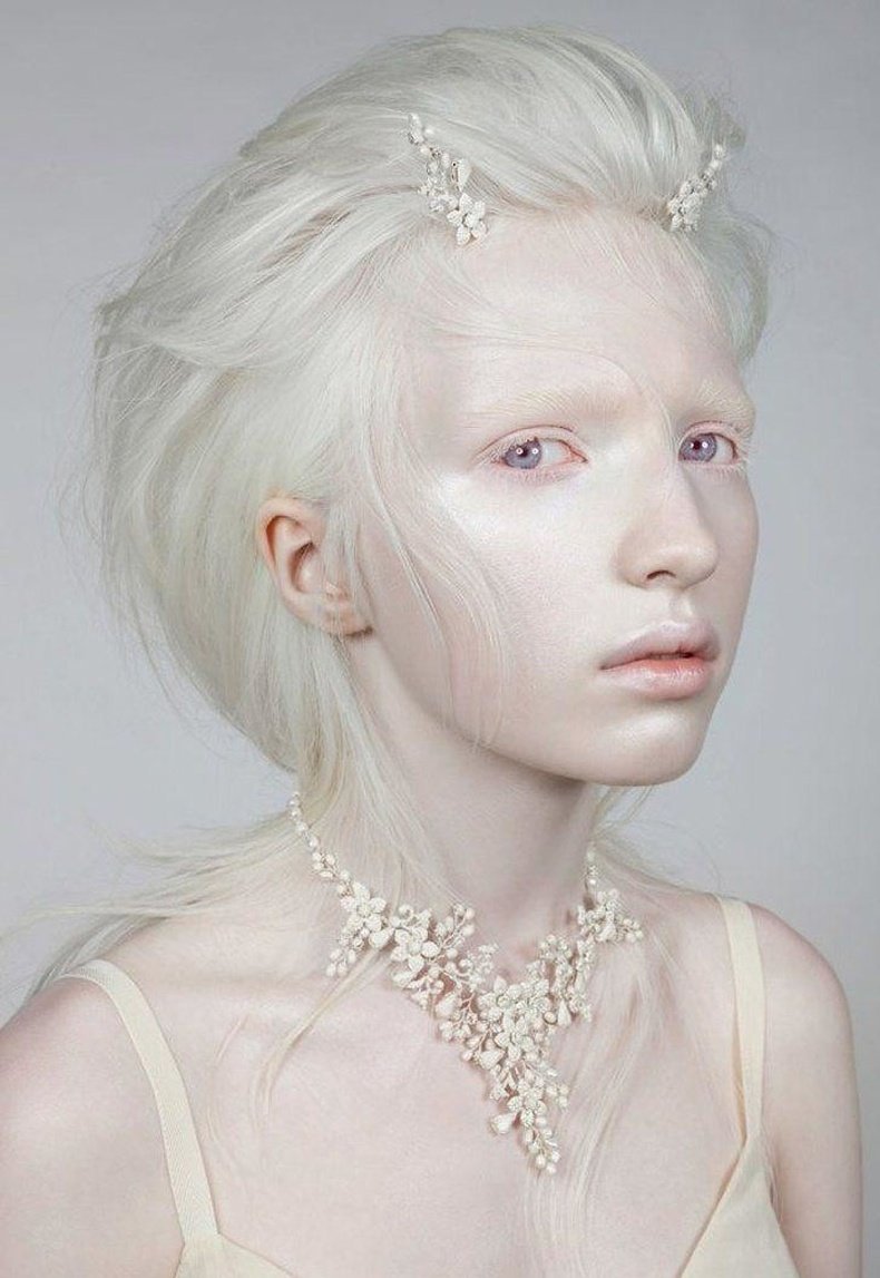 Амаль Софи альбинос