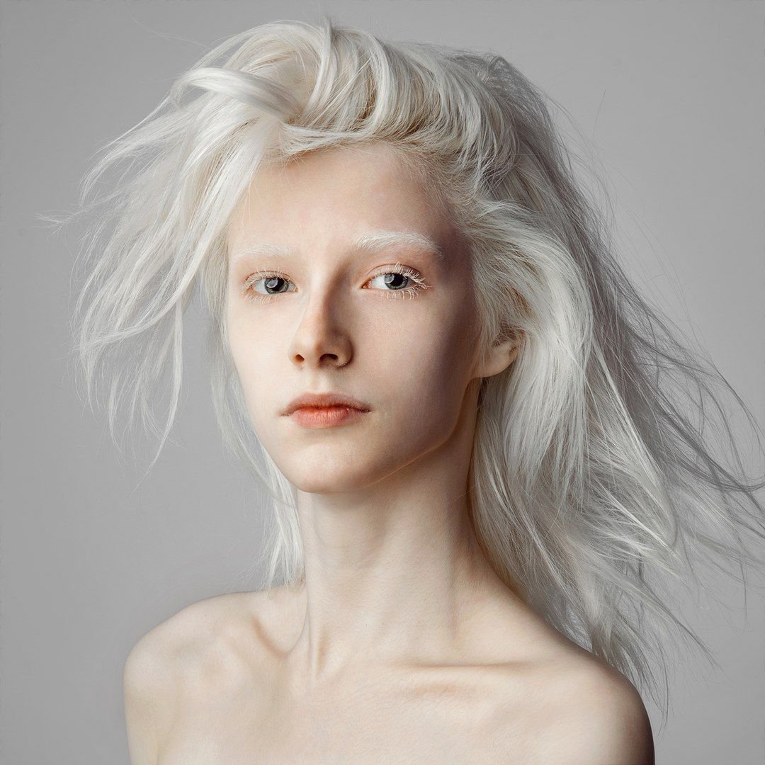 Альбинос референс