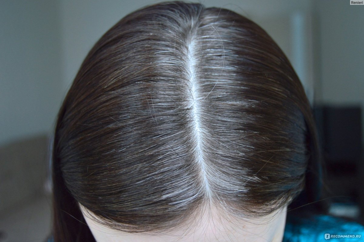 Отросшие Седые корни
