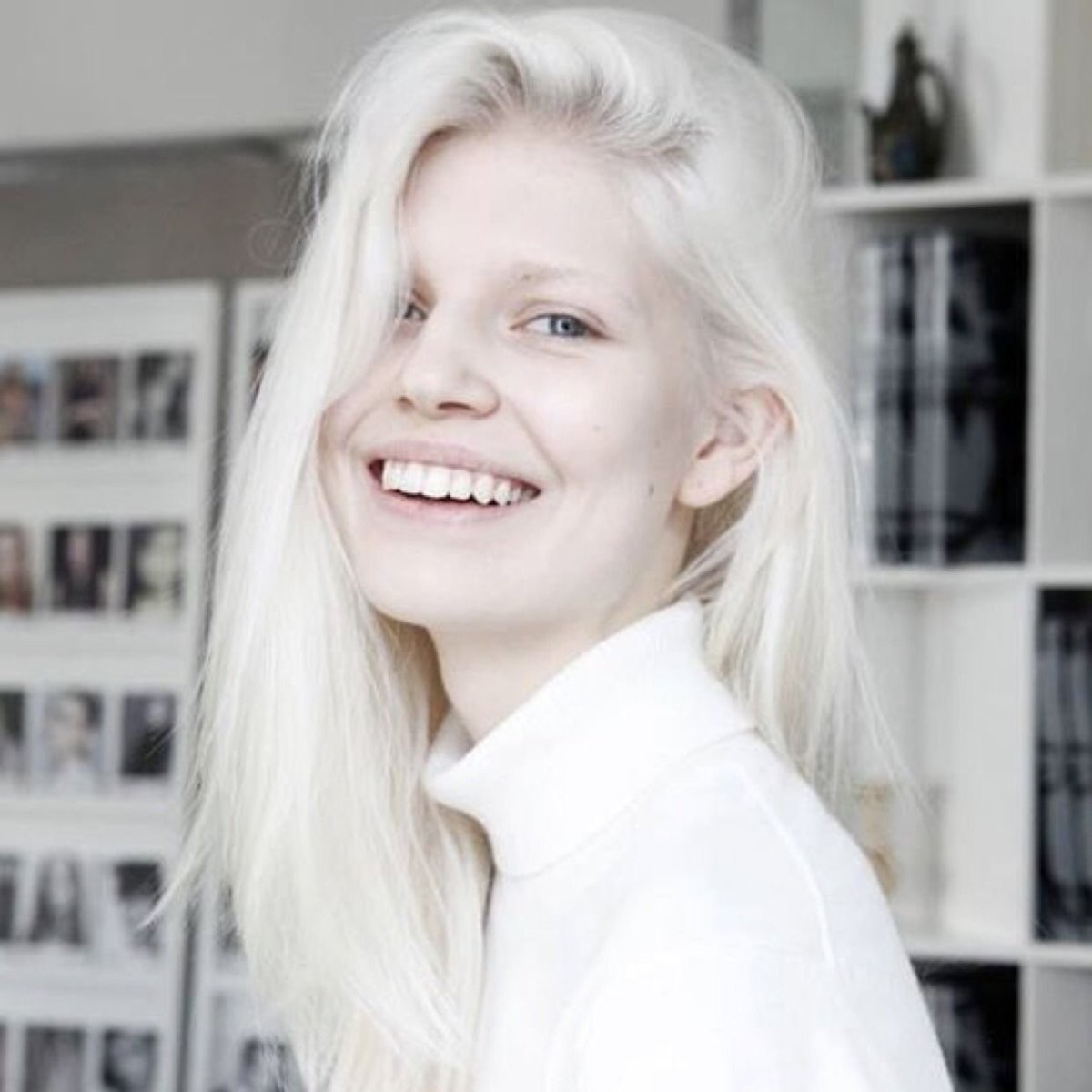 Таня Румянцева альбинос