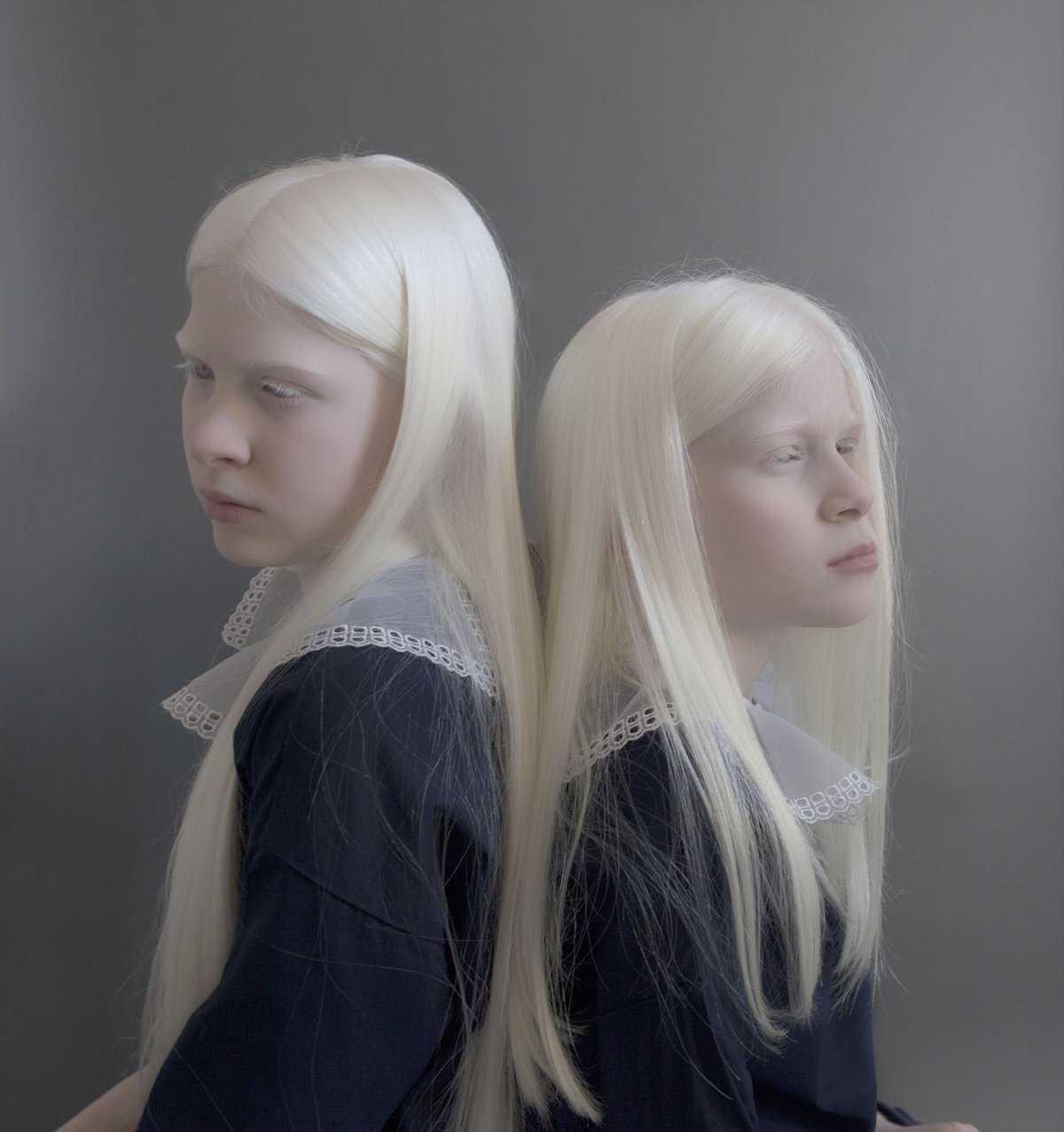 Альбинизм Эстетика