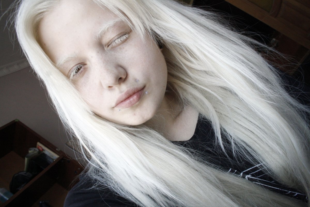 Елизавета Сорочинская альбинос