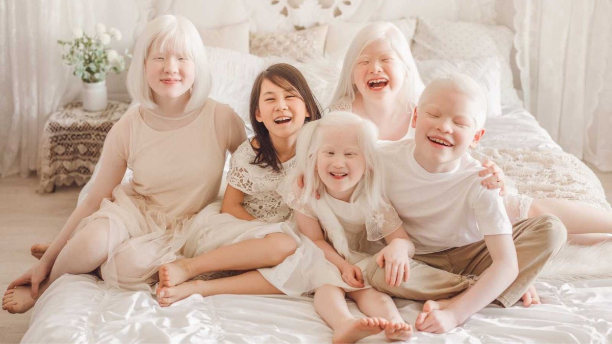 Семья альбиносов