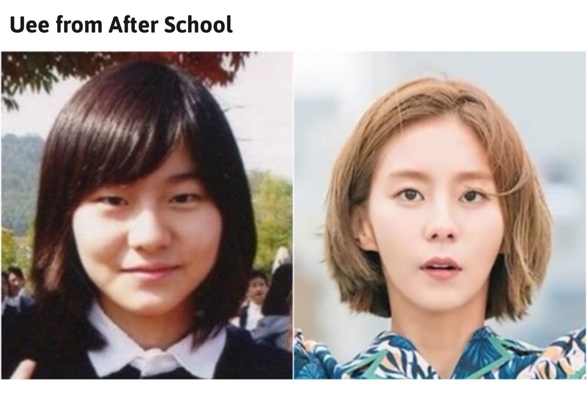 Kpop Idol до и после пластики