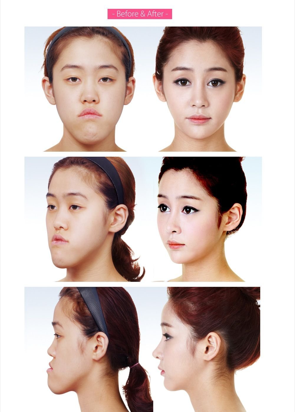 Пластическая хирургия в Корее