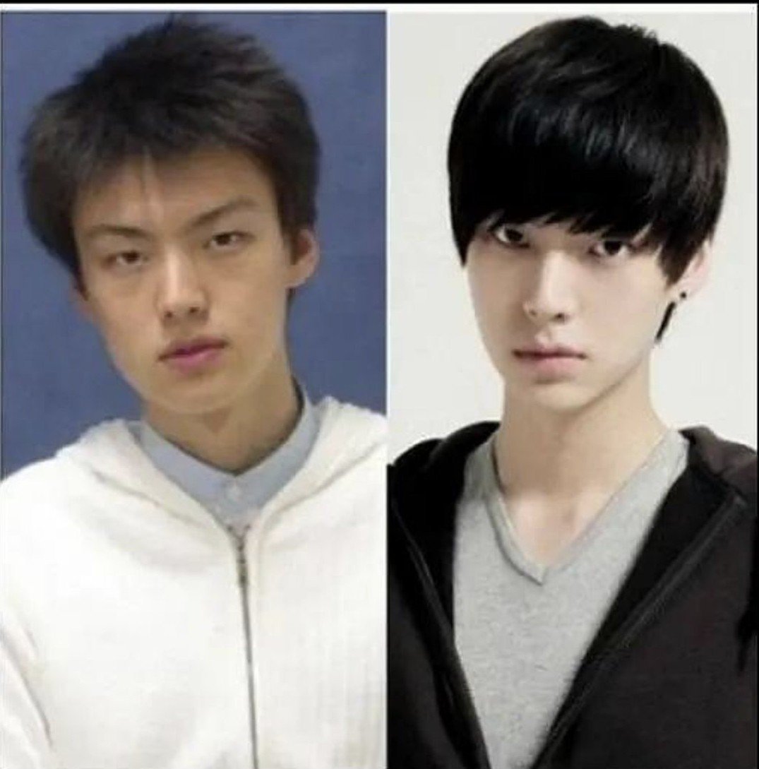 АН Дже хён пластика