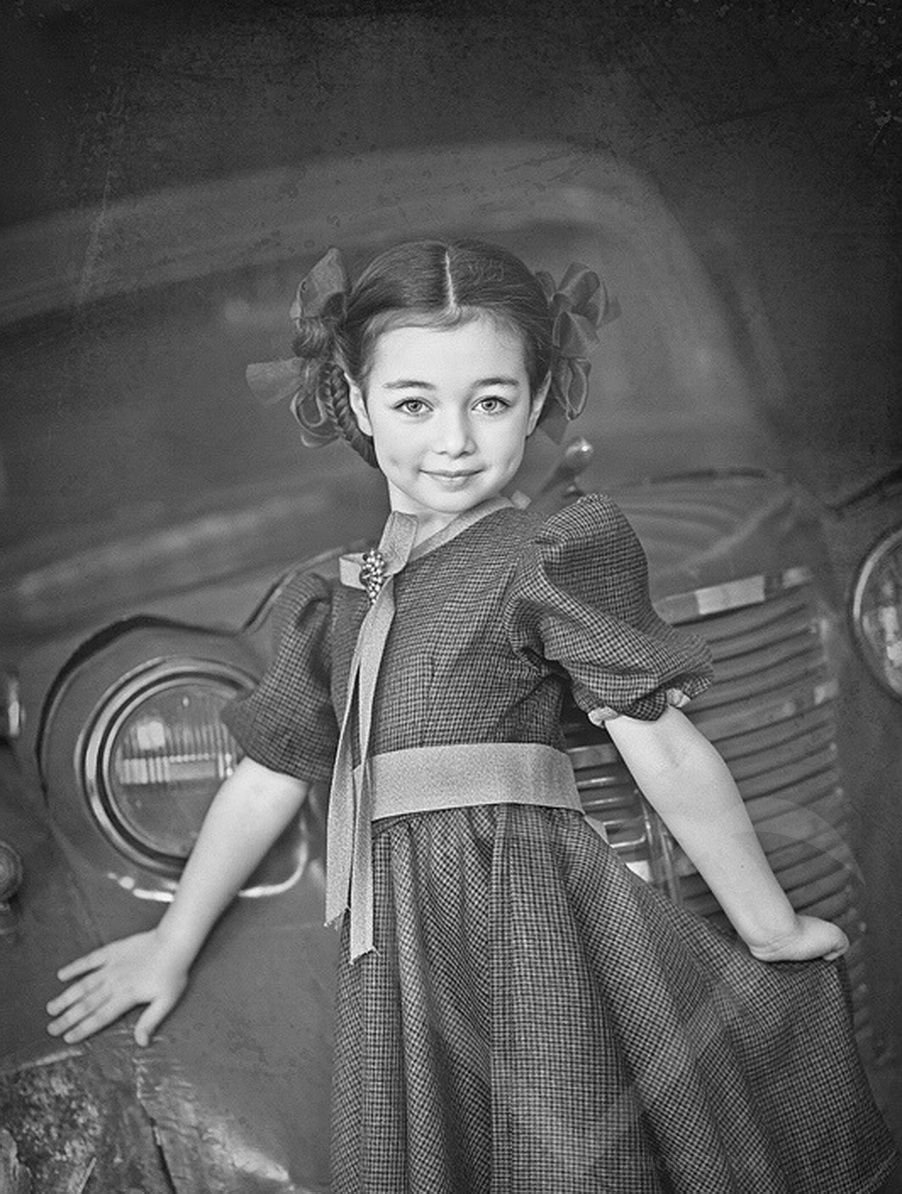 Карина киль до и после