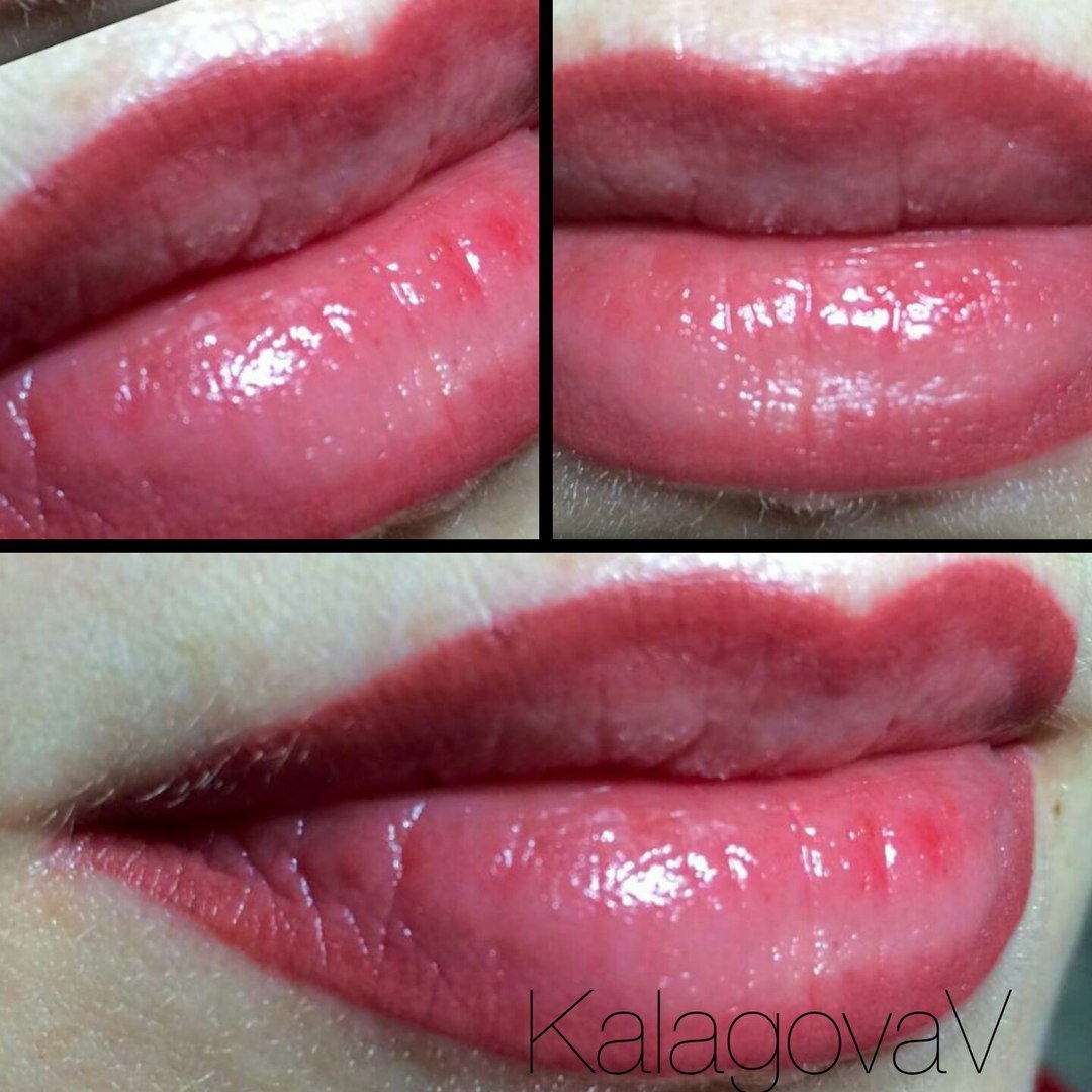 Зажившие губы после перманента