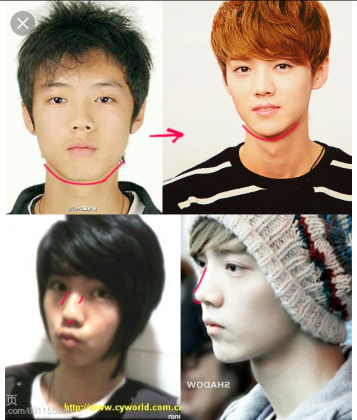 Лухан из Ехо до пластики