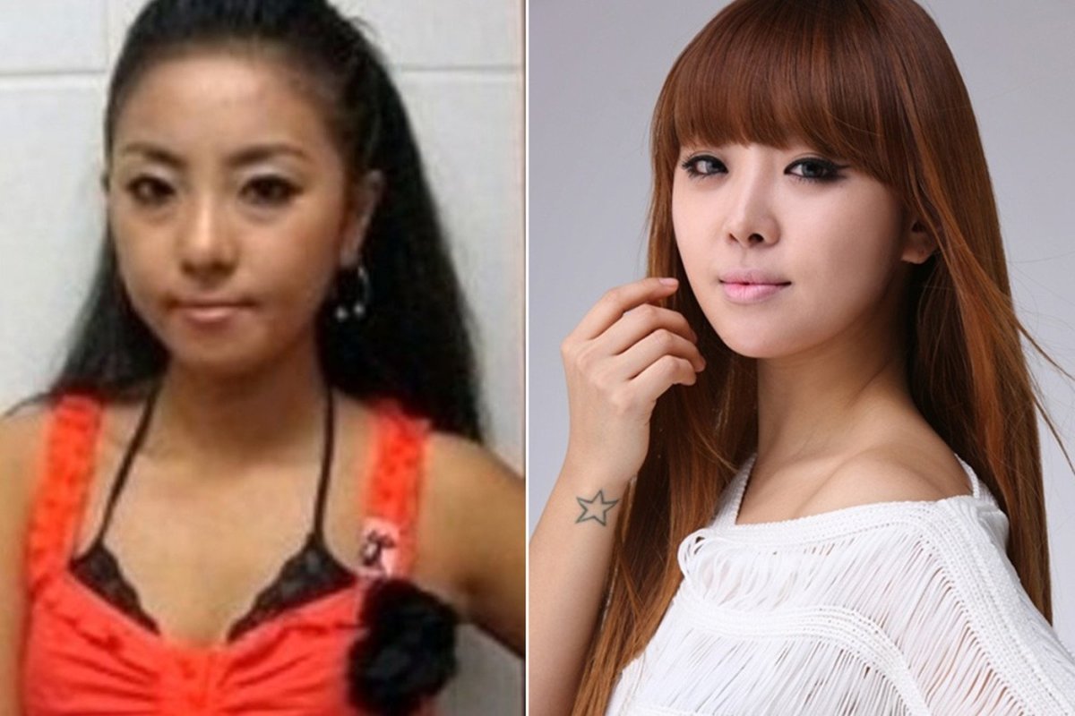 Корейские пластические операции