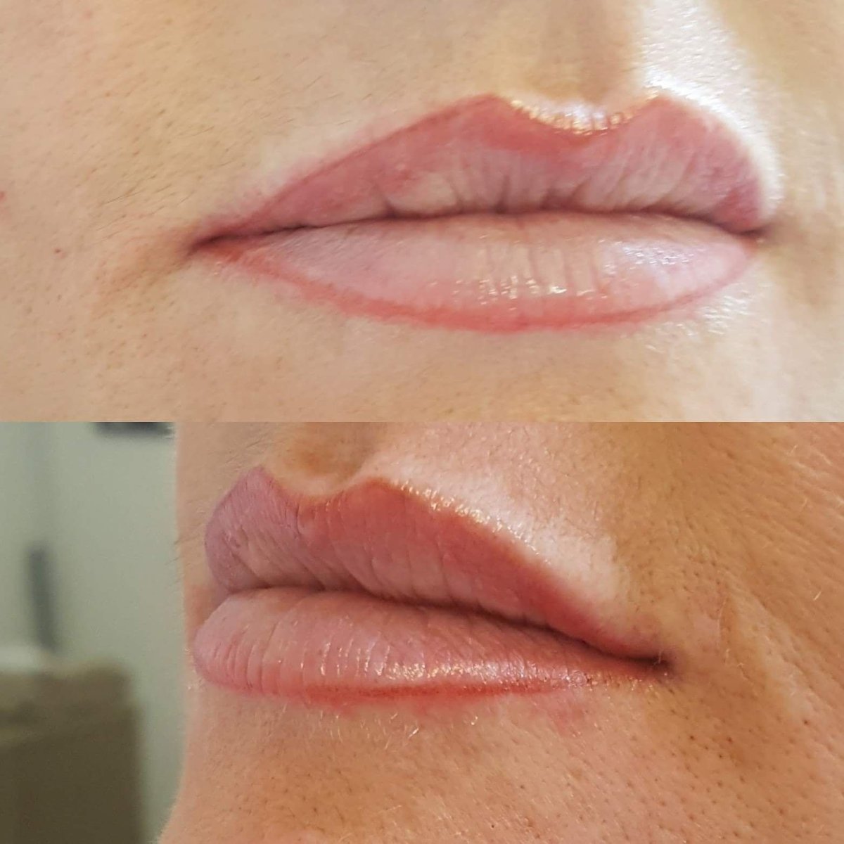 Белый татуаж вокруг губ