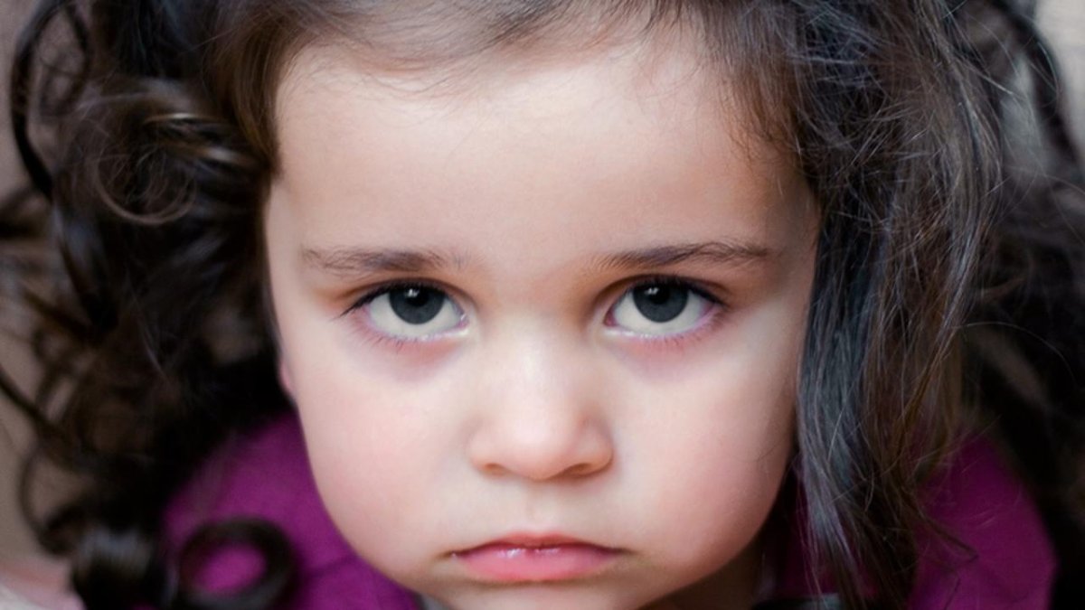 Синякипрд глазами у ребенка