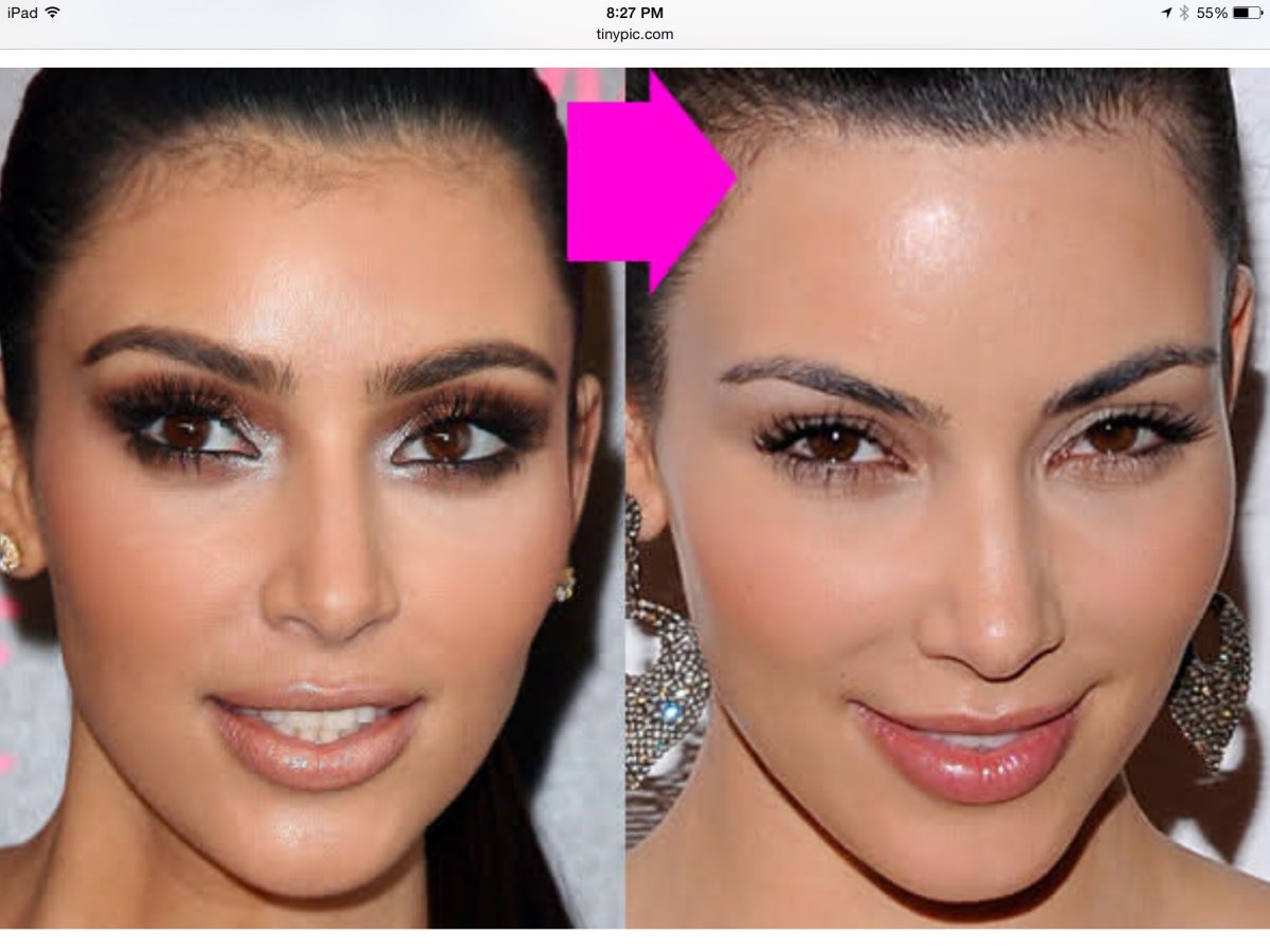 Ким Кардашян линия роста волос