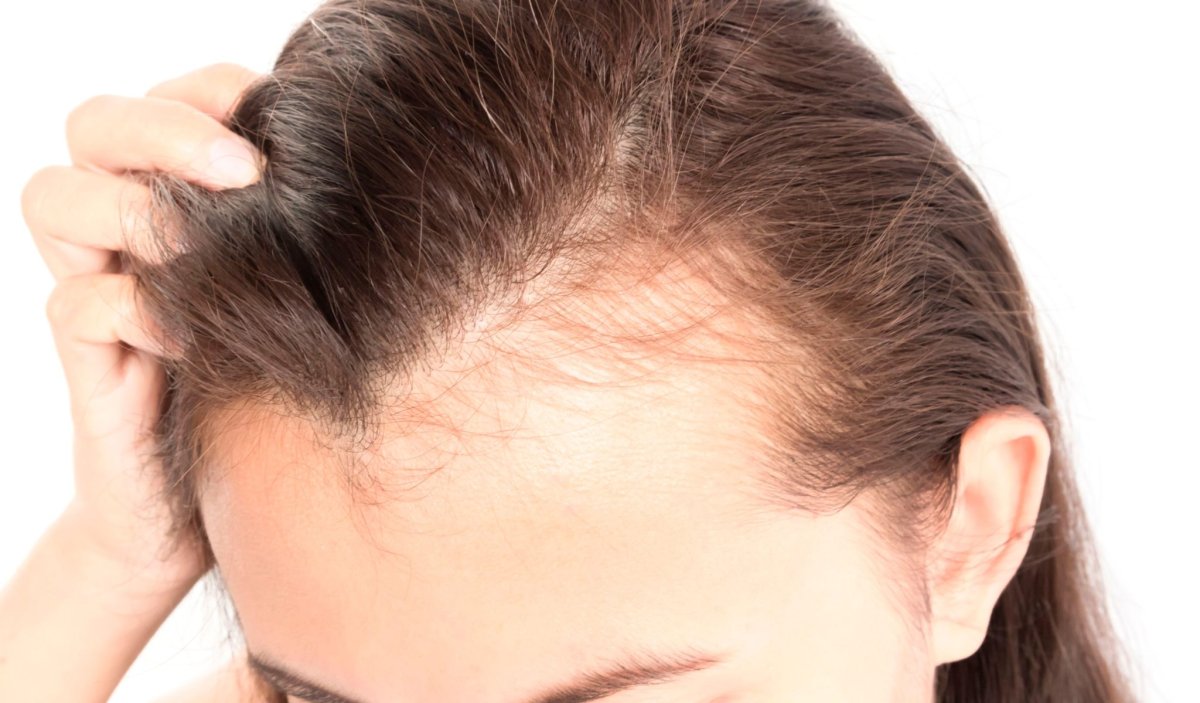 Редеют волосы