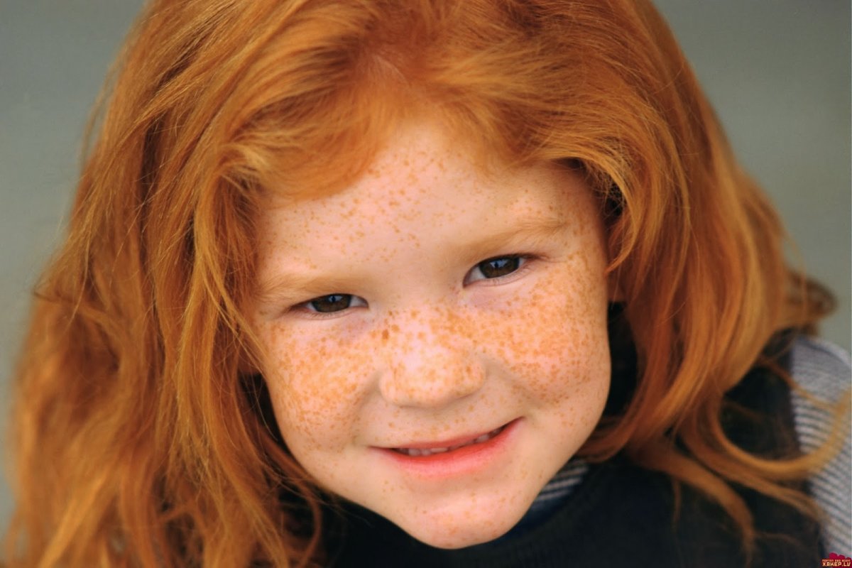 Светлана Иванова веснушки